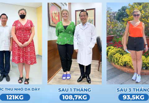 Giảm cân sau sinh bằng phẫu thuật nội soi thu nhỏ dạ dày